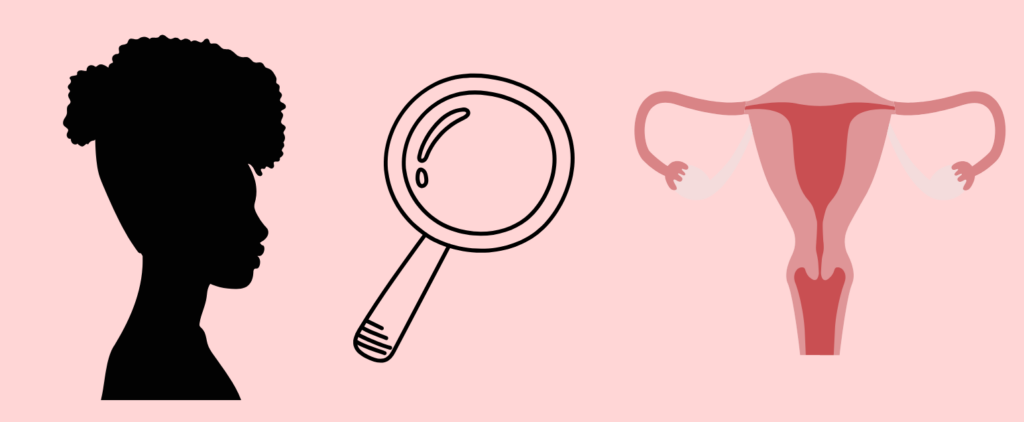 Fibroids and Inequity: How Racism Shapes the Care Black Women Receive